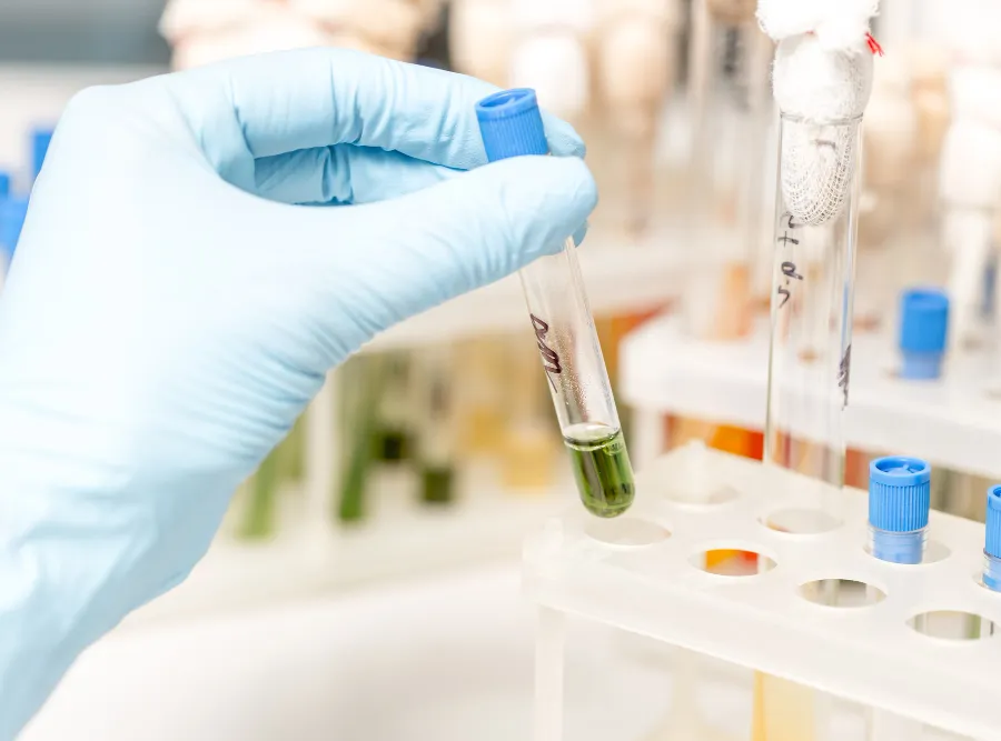 Muestras de laboratorio para análisis de fisiología en MOVID